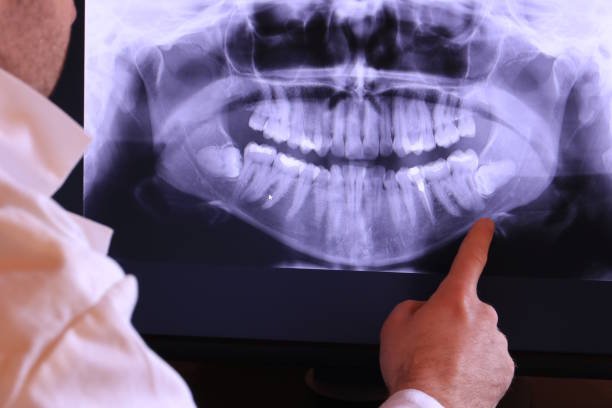 Best Emergency Dental Care for Sports Injuries in Magalia, CA